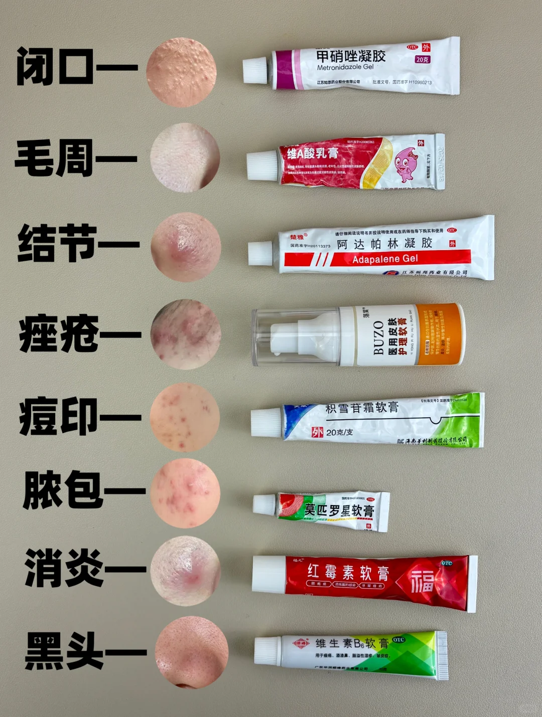 码住，痤疮的姐妹用得上！