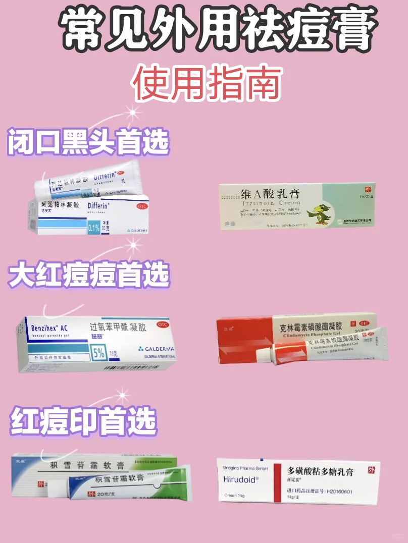 祛痘膏你真的会用吗？个人使用心得