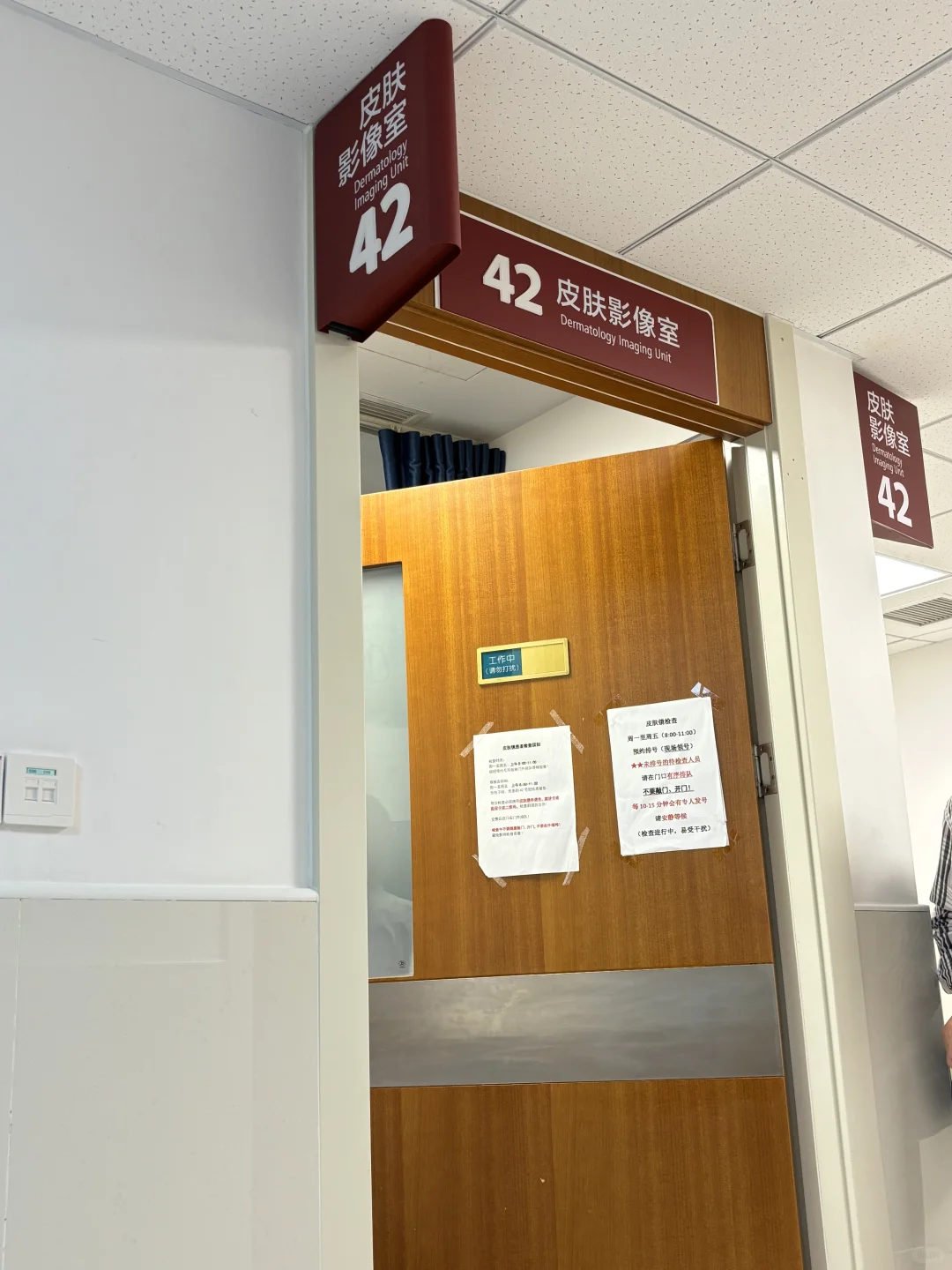 华山医院 脂溢性脱发 鼻翼泛红 脂溢性皮炎