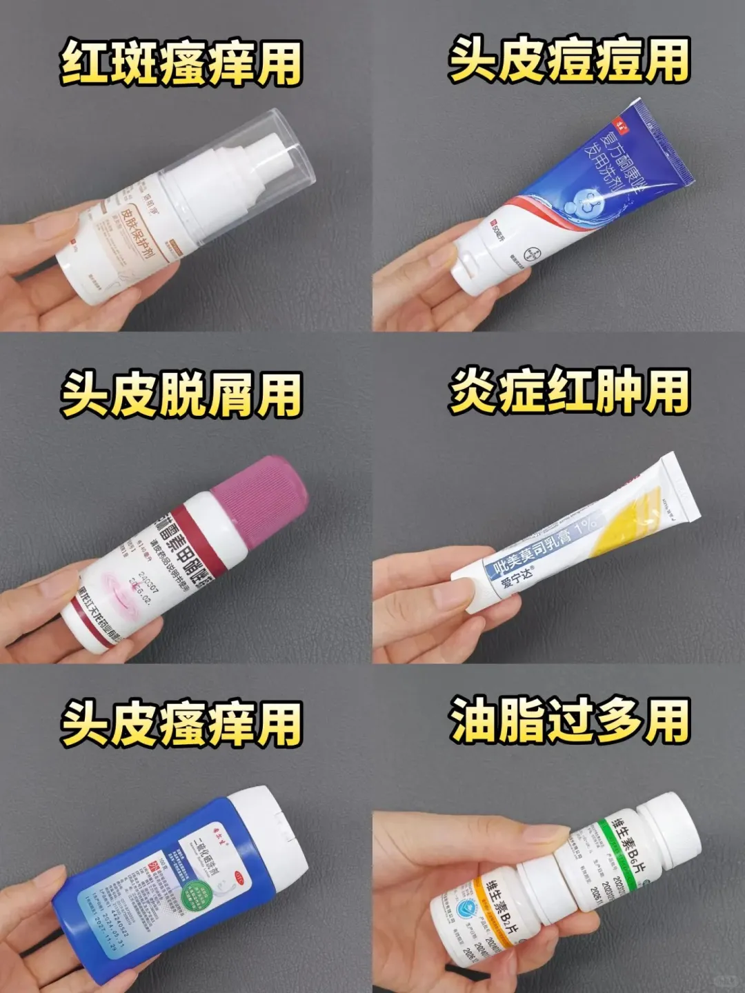 高性价比脂溢性皮炎药膏集合！小💰办大事