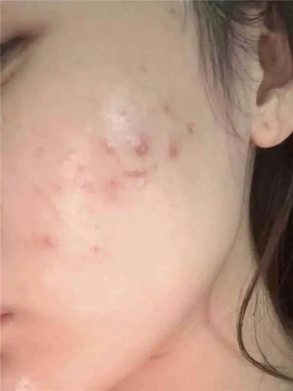 什么牛马 涨薪不长痘！