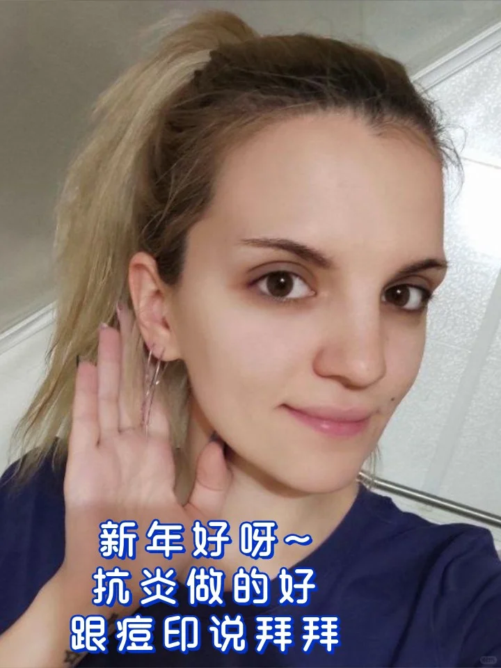 节后闭口、痘痘大作战